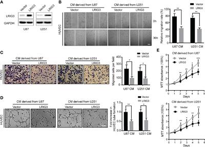 LRIG3 Suppresses Angiogenesis by Regulating the PI3K/AKT/VEGFA Signaling Pathway in Glioma